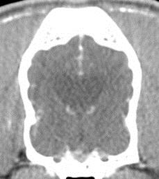 Le pause tra le sedute di radioterapia permettono