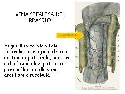 la diretta continuazione della vena basilica. E importante sapere dov è a livello anatomico perché la vena basilica generalmente è utilizzata per le fistole un po più complesse.