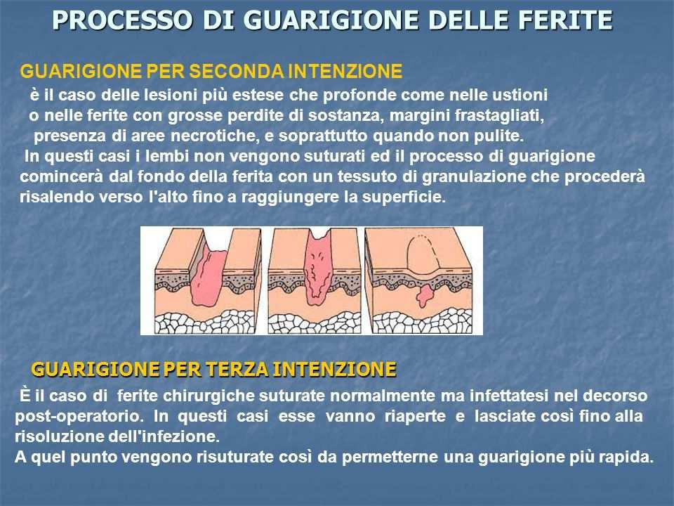 del sistema circolatorio (aterosclerosi); Disordini ematologici