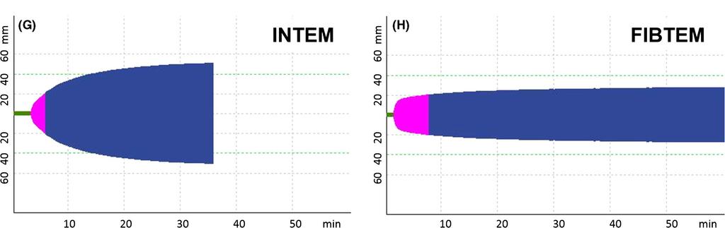 ROTEM a 16h Normalizzazione