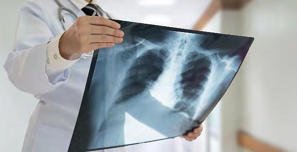 AVVELENAMENTO IN CASA Tumore ai polmoni, il 10% delle morti causate dal gas radioattivo radon 28 Ottobre 2018 E' un killer silenzioso.