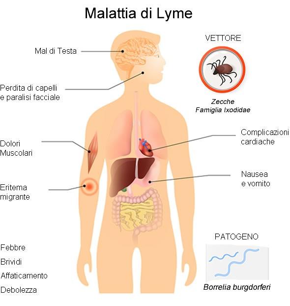 BORRELIOSI - ZECCHE MALATTIA DI LYME La borreliosi è una malattia multisistemica veicolata dalle cosiddette "zecche del bosco" (Ixodes ricinus), che vivono principalmente nelle aree rurali e boschive.