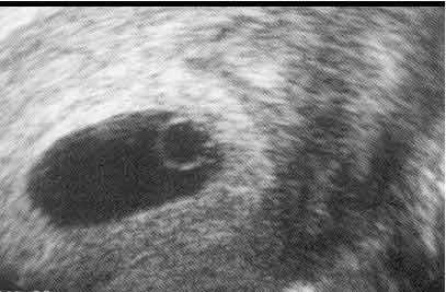 Sacco Vitellino Sempre visibile prima dell embrione