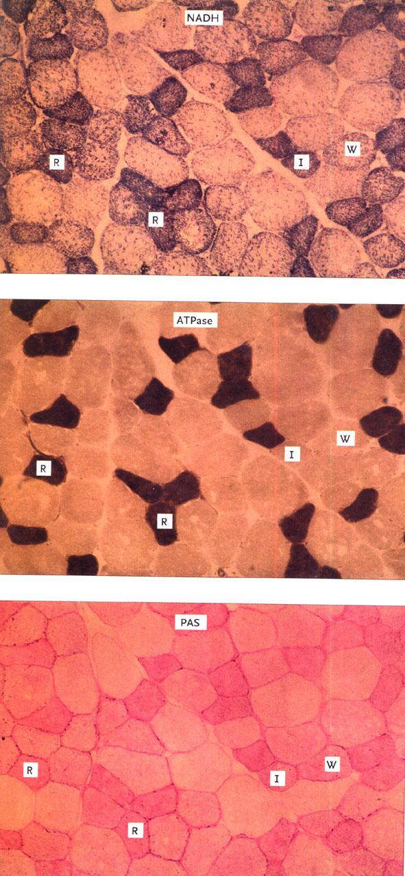 Colorazioni istochimiche rilevano attività enzimatiche diverse nelle fibre I e II alta capacità ossidativa, SDH produce NADH Il ph acido inibisce ATPase nelle fibre veloci, ma non nelle lente