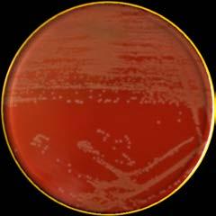 hemolysis developed around the