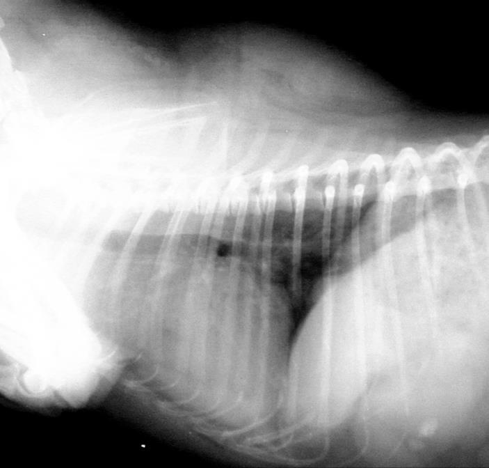 PARETE TORACICA Segni radiografici Opacizzazioni extracostali diffuse