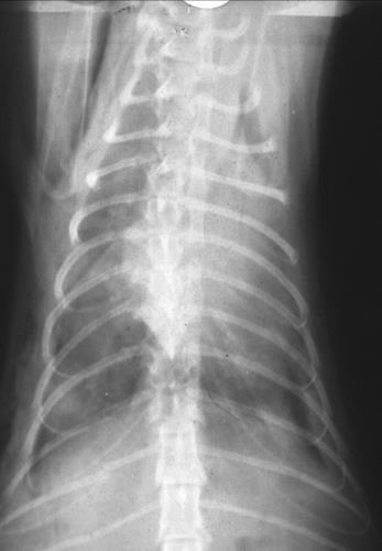 Segni radiografici PARETE TORACICA Radiolucenze extracostali focali lacerazioni punture o ferita da punta lesioni da