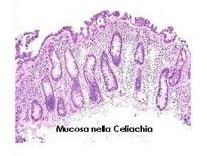 sangue 2) Biopsia enterica Esame della