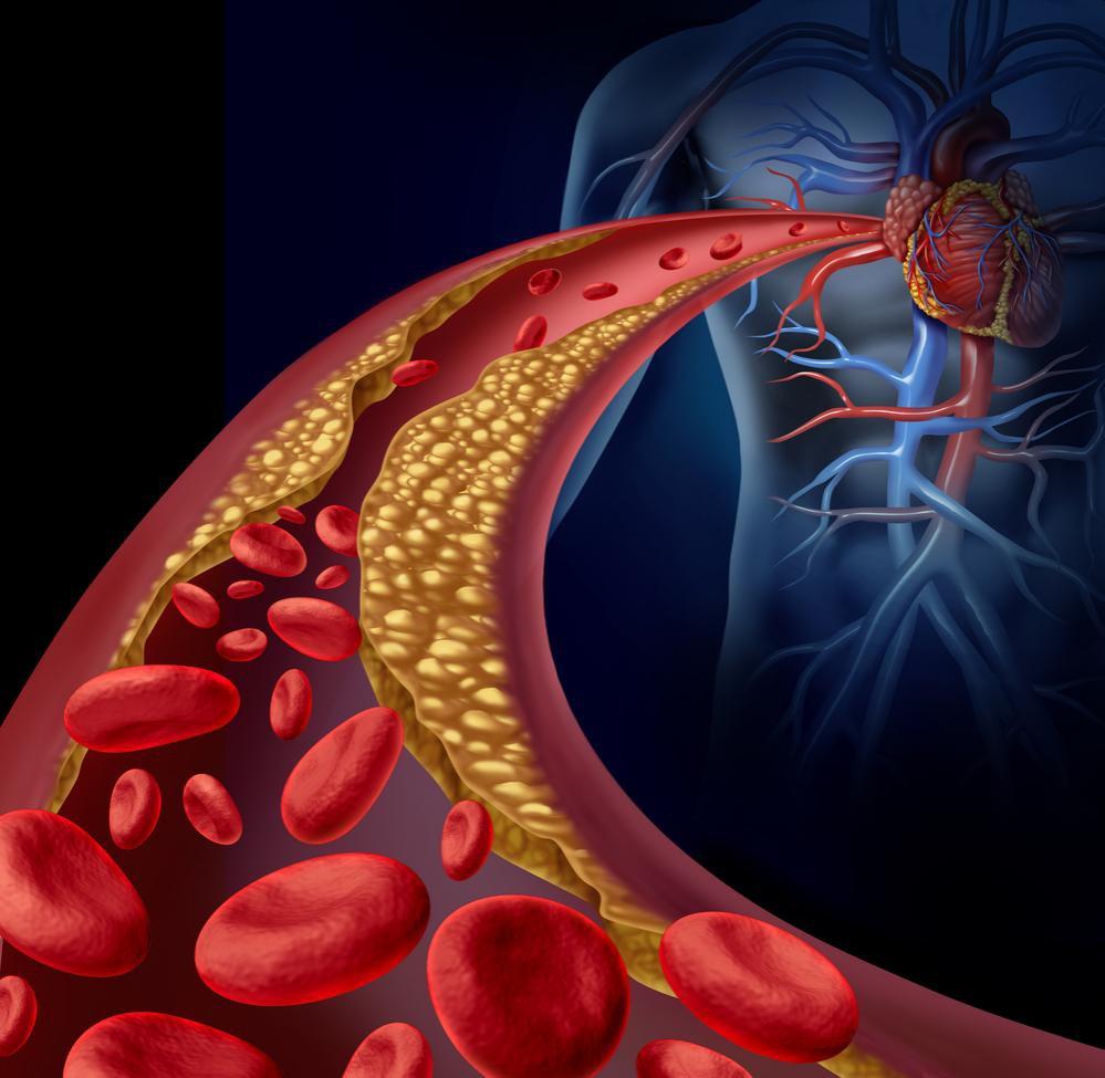 STRESS/Sistema cardiocircolatorio L'eccessivo rilascio di catecolamine può provocare alterazioni del ritmo e frequenza cardiaca, ipertensione Lo stress inoltre