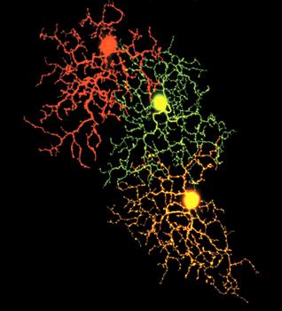 Eccitotossicità del Glutammato Stress Ossidativo Accumulo di