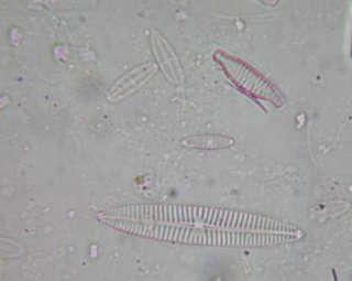 Fig 8. Diatomee bentoniche fluviali, visione al microscopio (ingrandimento 1000X).