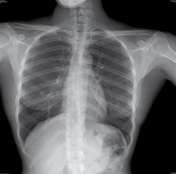 Flessibilità d uso per acquisizione di immagini da proiezioni difficoltose e/o a contatto diretto con il