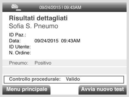 Lo schermo dell analizzatore Sofia visualizzerà i risultati dei controlli procedurali come valido o non valido e fornirà un risultato positivo o negativo per il rilevamento dello Streptococcus