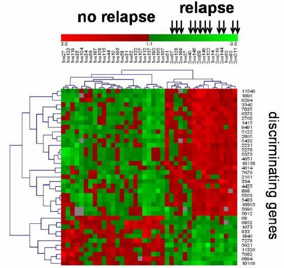 Analysis of gene expression Gene expression profile of relapsing versus non-relapsing Wilms tumors.