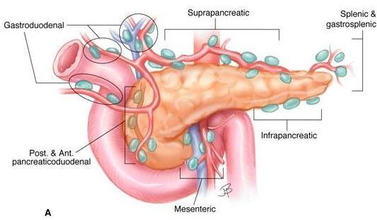 Criticità Imaging invasione linfatica - 4 categorie di linfonodi locoregionali: 1. Sovra-pancreatici sopra il corpo e testa pancreatici 2.