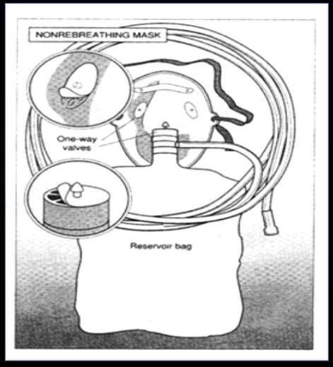 Maschera con reservoir E un sistema a basso flusso caratterizzato da una maschera dotata di un pallone di riserva (serbatoio) che consente di risparmiare