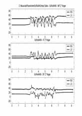 in ampiezza o nel tempo) quantificare gli effetti diretti e indiretti (compensi, effetti su altri distretti) di supporti ortesici e splint IFD Centro di