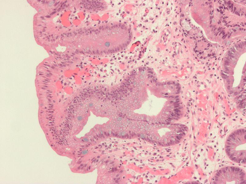 epitelio cilindrico semplice con cellule mucipare caliciformi, tipiche del tratto gastrointestinale.