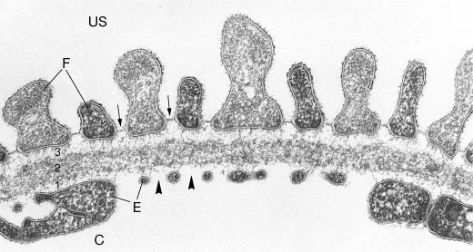 COMPONENTI Podociti e Slit diaphragms GBM Cellule endoteliali BARRIERA DI FILTRAZIONE MECCANISMO D AZIONE 1) REPULSIONE ELETTROSTATICA DELLE PROTEINE ANIONICHE DA PARTE DEL POLIANIONE DELLA