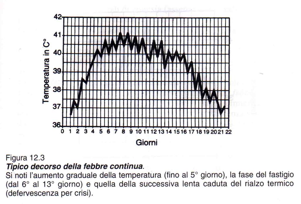 Tipi di febbre Tipi di febbre: il rialzo termico febbrile assume andamenti caratteristici a seconda