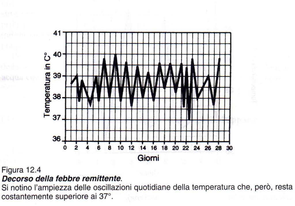 Febbre continua: si mantiene sempre al di sopra dei 37 C nonostante le oscillazioni giornaliere (tifo