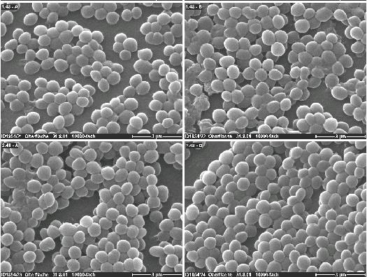 Protezione Antibatterica Riduzione dell adesione batterica Inibizione della