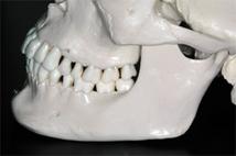 /ossa mascellari si è venuto ad atrofizzare, e la lunghezza anteroposteriore dell'osso della mandibola e della mascella si è ridotta.