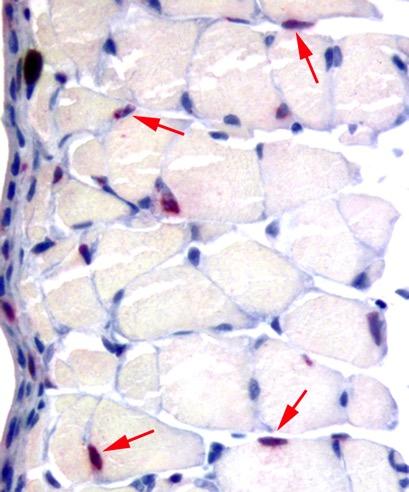 BrdU Immunostaining