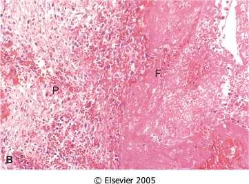 incontro a morte cellulare per apoptosi e