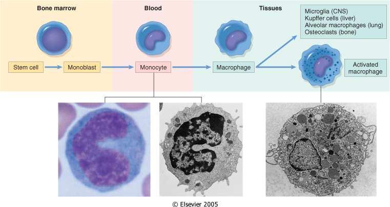 INFIAMMAZIONE CRONICA Risposta di lunga durata (settimane o mesi) alla lesione, in cui è prevalente la componente cellulare mononucleata (istoflogosi) e in cui i fenomeni infiammatori e demolitivi