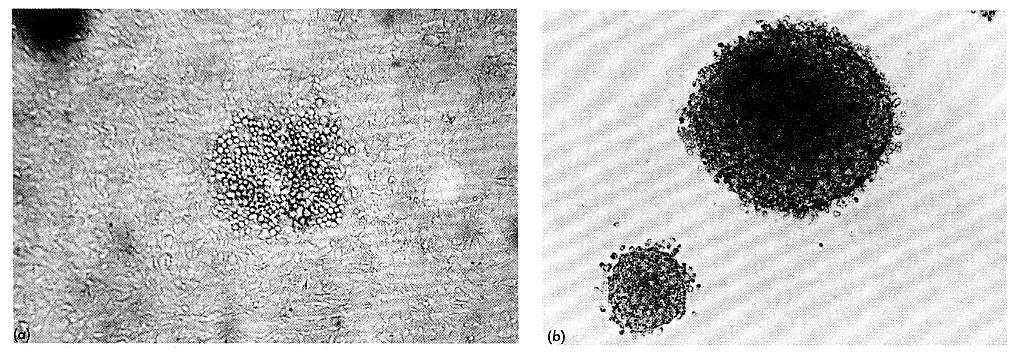 Le cellule si possono trasformare anche in vitro Due saggi più usati per la trasformazione di cellule animali con virus tumorali Saggio della formazione del focus.