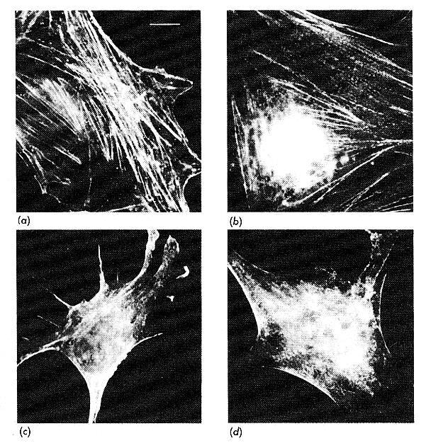 In questa figura viene paragonata l organizzazione delle proteine muscolari di cellule normali con quelle tumorali di topo.