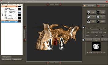 Software di analisi NewTom NNT Il software NNT è l implementazione perfetta per l imaging 2D e 3D.