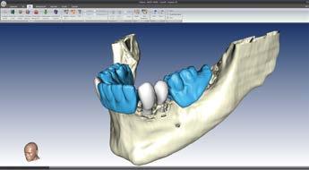 2D & 3D Il software genera panoramiche, sessioni cross e modelli ossei in 3D, leggendo le assiali.