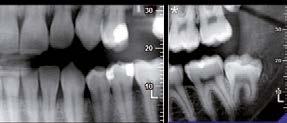 apparecchi ortodontici e degli