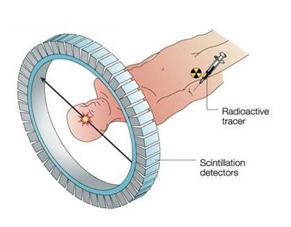 Applicazioni del decadimento : PET La PET (Positron Emission Tomography): è una tecnica usata in medicina nucleare che produce immagini 3D dei processi funzionali degli organismi.