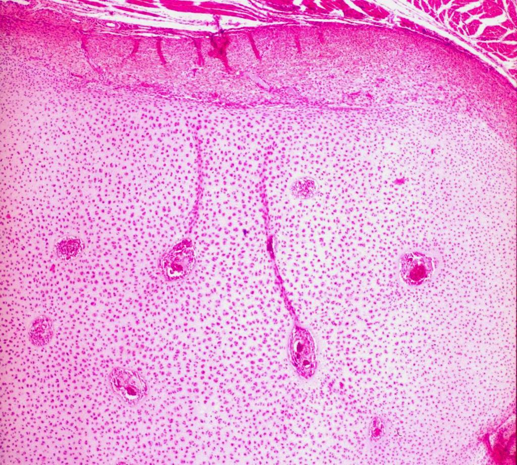 Ossificazione dell epifisi (fase iniziale) Vasi sanguigni Siti