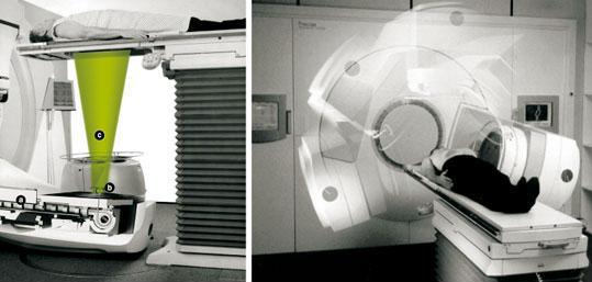 La Radioterapia Normalmente la radioterapia si effetta con elettroni o quanti (raggi) X prodotti da elettroni.