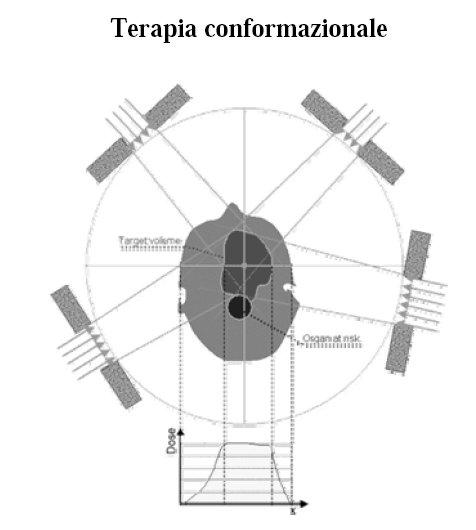 Uso di fasci multipli