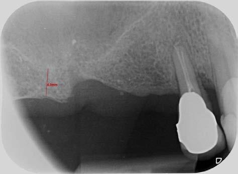 Un altro utilizzo consiste nel fatto che gli impianti molto larghi possono essere inseriti anche