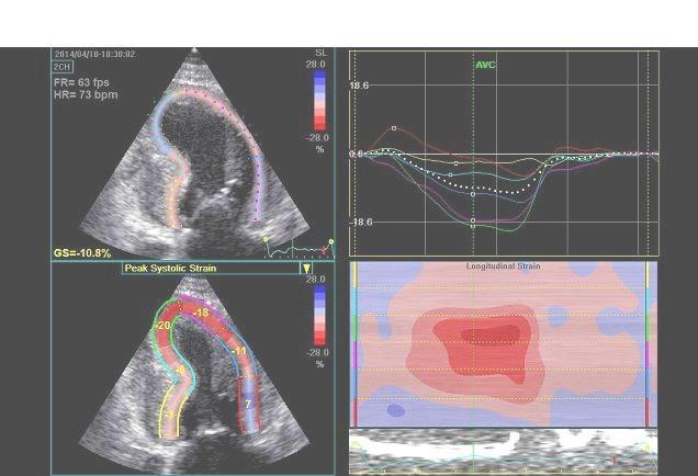 USO DEL CONTRASTO NELL ECOCARDIOGRAFIA TUTORS: A. Barchitta, A. Cherubini, M. Fisicaro, C. Mazzone, C.