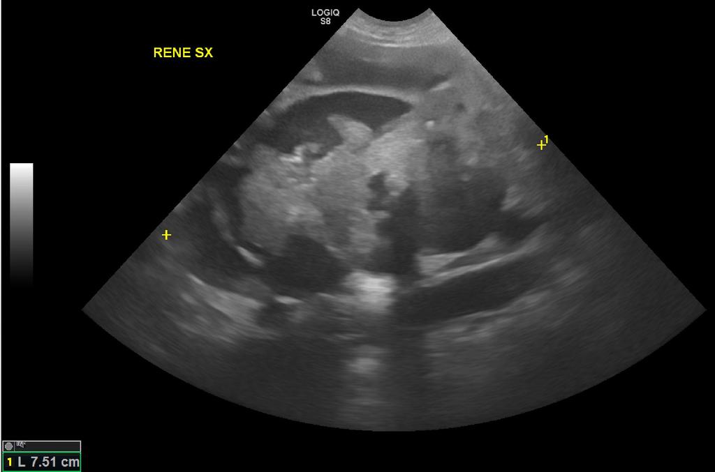 NEOPLASIE