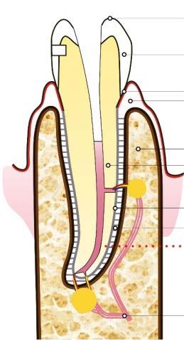 Si ritenta allora di arrivare comunque all apice del dente, rimuovendo prima con difficoltà il precedente materiale messo nel dente dal collega, poi gli ultimi millimetri