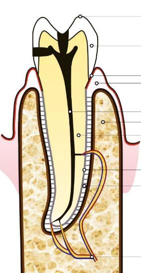 Sopra da sinistra a destra: 1) dente con STUDIO carie che ha ODONTOIATRICO determinato la necrosi pulpare (la polpa morta è evidenziata in nero),2) il dente è stato aperto, la polpa è stata rimossa