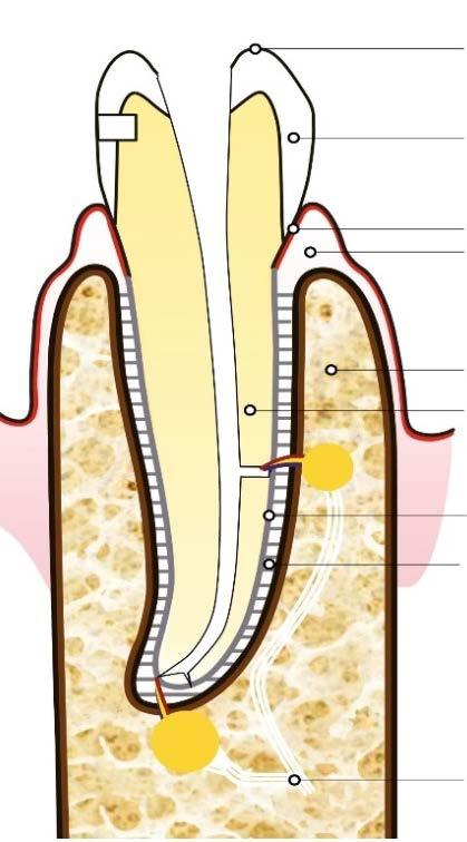 Trattamento endodontico della necrosi pulpare/granuloma in fase sintomatica (con ascesso).