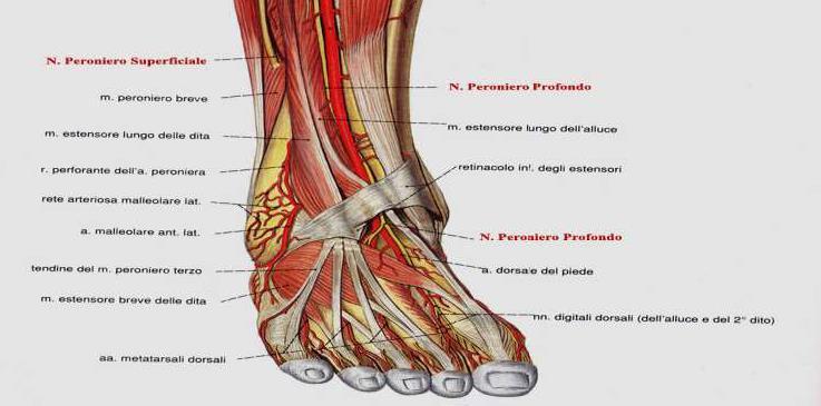 Sindrome del Tunnel Tarsale Anteriore EZIOLOGIA: compressione del ramo terminale del Nervo Peroneo Profondo a livello