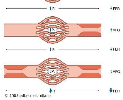 autoregolazione renale Resistenza arteriole afferenti R a P CG e VFG ( FER) R a P