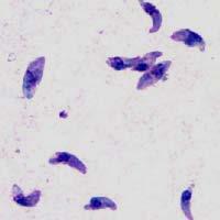 Tachizoiti Rapidly growing stage observed in the early stage of infection.