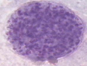 DIAGNOSI Sierologia su fluidi fetali PCR