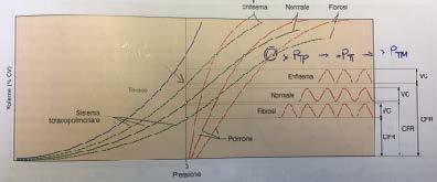 (1) Nel diagramma pressione-volume del sistema toraco-polmonare, si può evidenziare che, inizialmente, le proprietà meccaniche del sistema sono essenzialmente simili a quelle del torace.